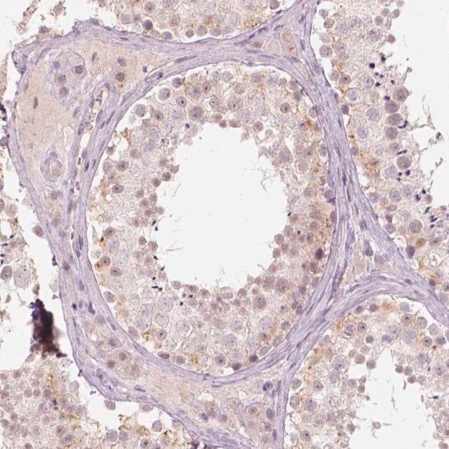 Anti-DLX6 antibody produced in rabbit