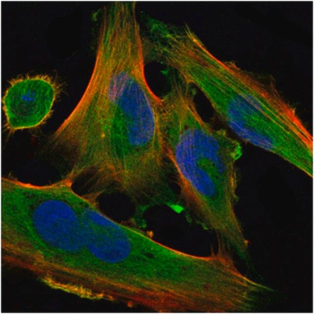 Anti-DLK1 Antibody, clone 3A10