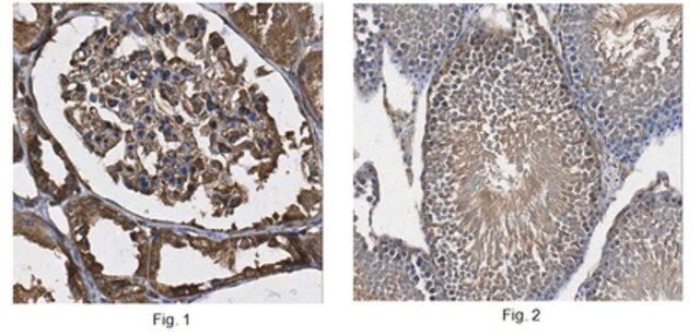 Anti-DMRT2 Antibody | ABE1364