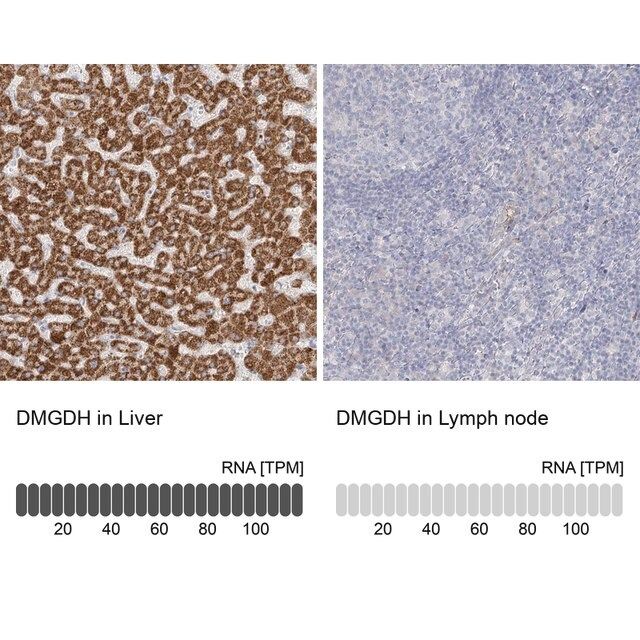 Anti-DMGDH antibody produced in rabbit