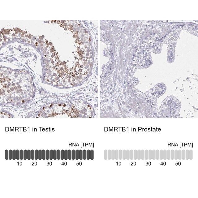 Anti-DMRTB1 antibody produced in rabbit