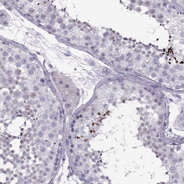 Anti-DMRT3 antibody produced in rabbit