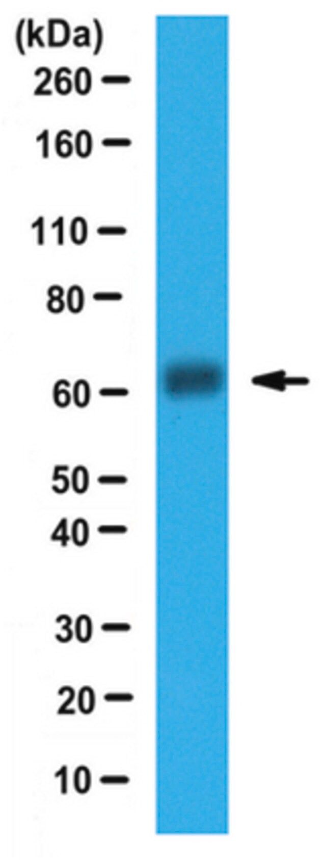 Anti-DMT1 Antibody