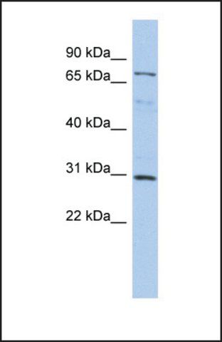 Anti-DMTF1, (N-terminal) antibody produced in rabbit