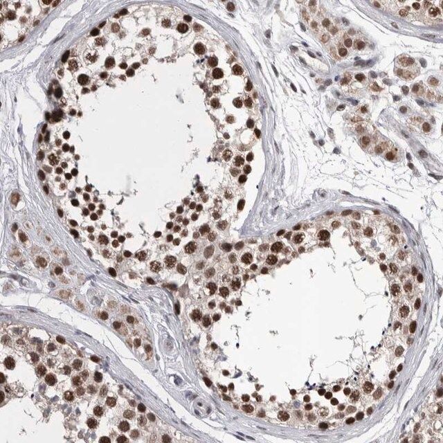 Anti-DMTF1 antibody produced in rabbit