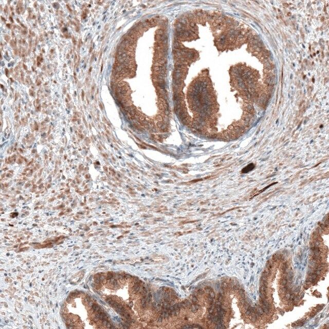 Anti-DMXL1 antibody produced in rabbit