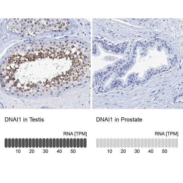 Anti-DNAI1 antibody produced in rabbit