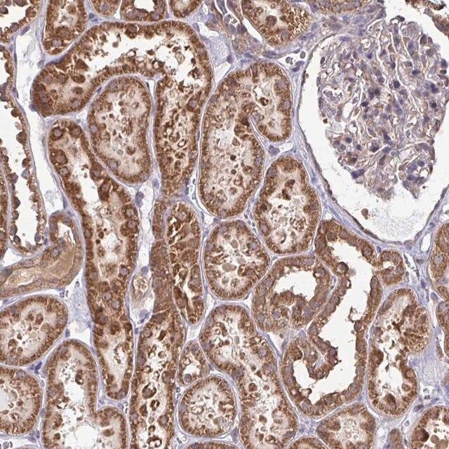 Anti-DNAJA2 antibody produced in rabbit