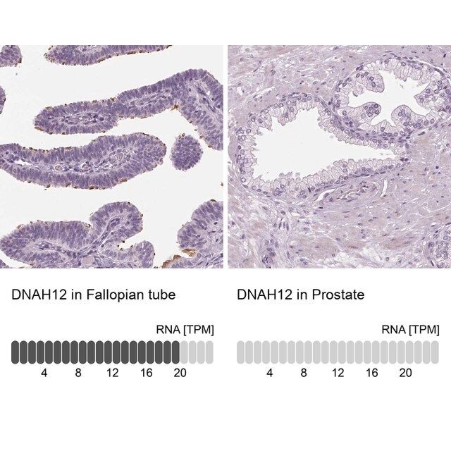 Anti-DNAH12 antibody produced in rabbit