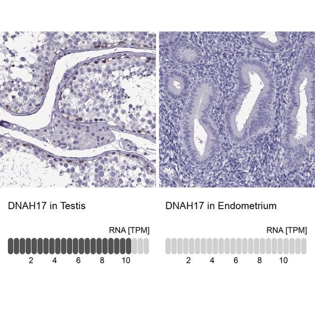 Anti-DNAH17