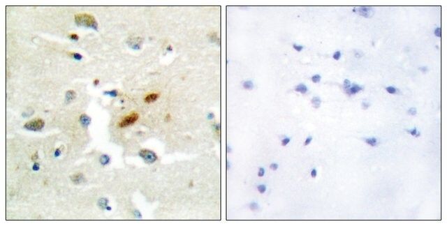 Anti-DNA Polymerase  antibody produced in rabbit