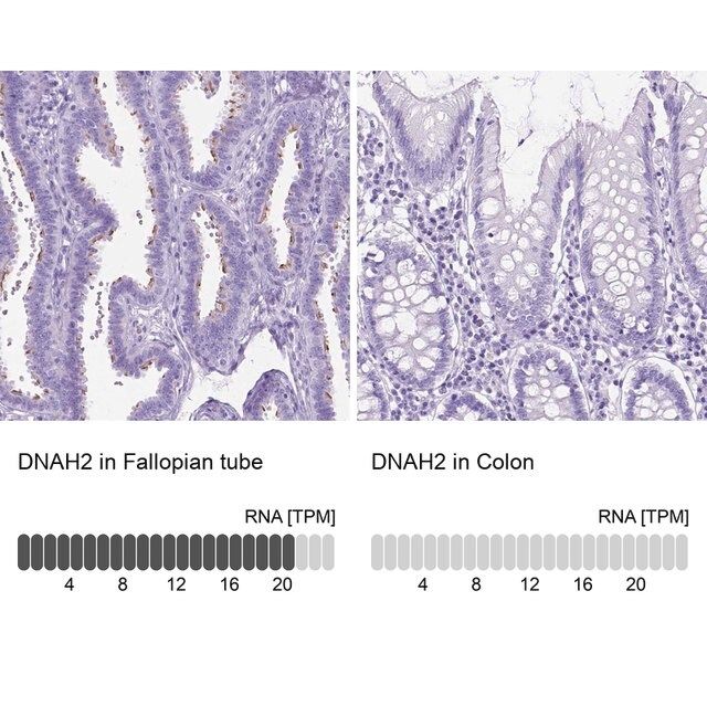 Anti-DNAH2 antibody produced in rabbit