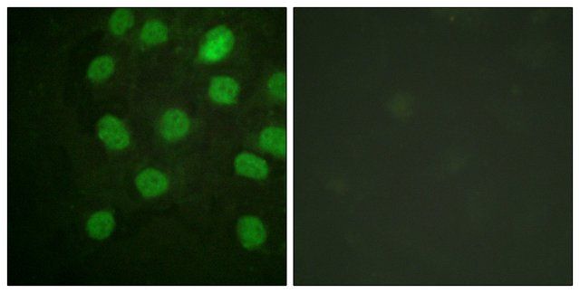 Anti-DNA-PK antibody produced in rabbit