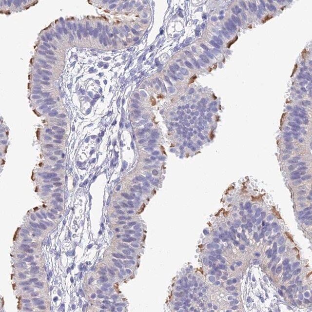 Anti-DNAH14 antibody produced in rabbit