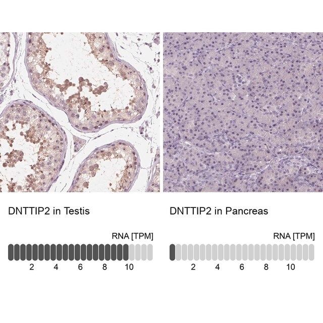 Anti-DNTTIP2 antibody produced in rabbit