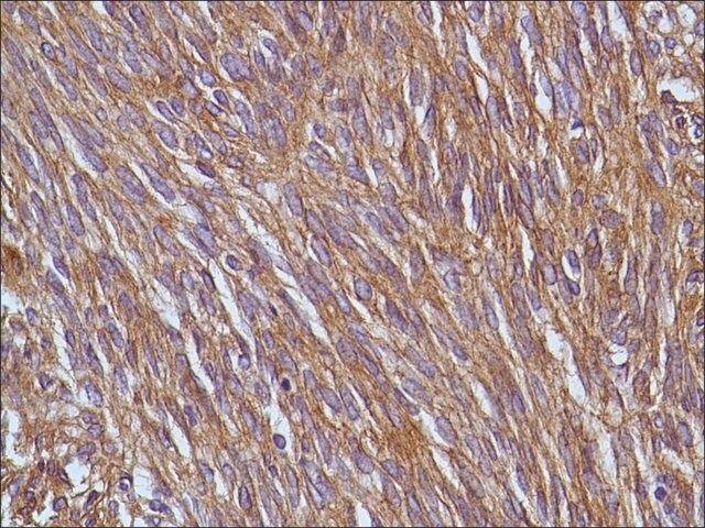 Anti-DOG-1 antibody, Rabbit monoclonal