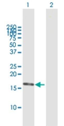 Anti-DNPEP antibody produced in mouse