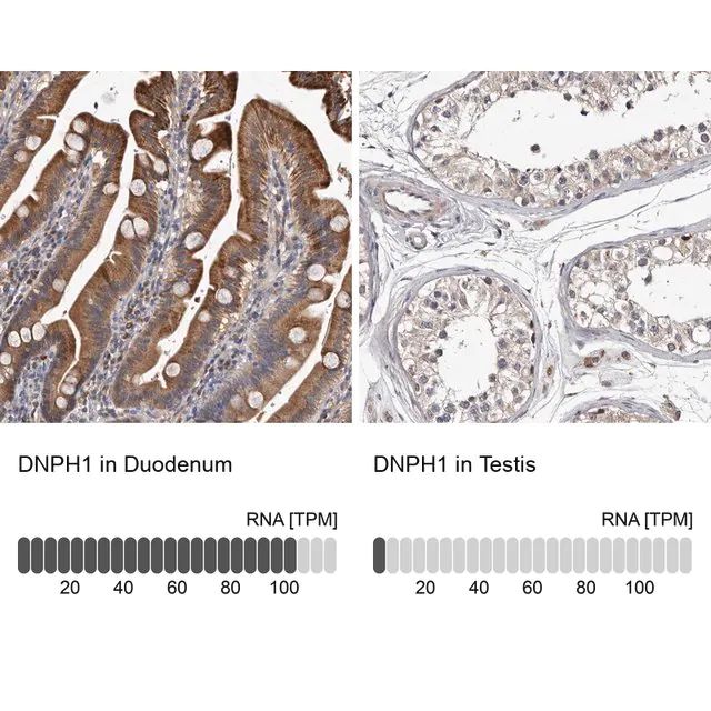 Anti-DNPH1 antibody produced in rabbit