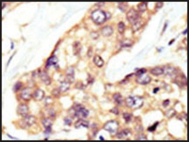 Anti-DOK5 (N-term) antibody produced in rabbit