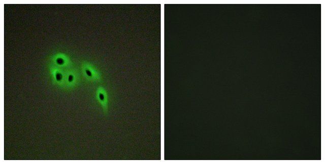 Anti-DOK6 antibody produced in rabbit