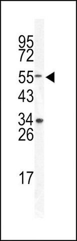 ANTI-DONSON (CENTER) antibody produced in rabbit