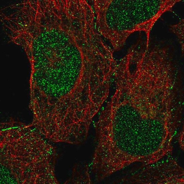 Anti-DOC2A antibody produced in rabbit