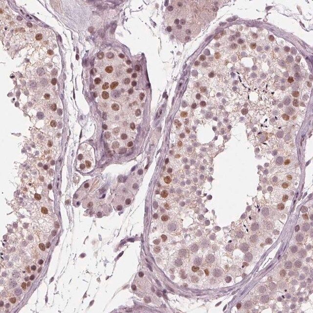 Anti-DNMT3L antibody produced in rabbit