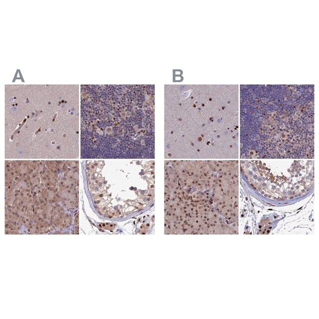 Anti-DNPEP antibody produced in rabbit