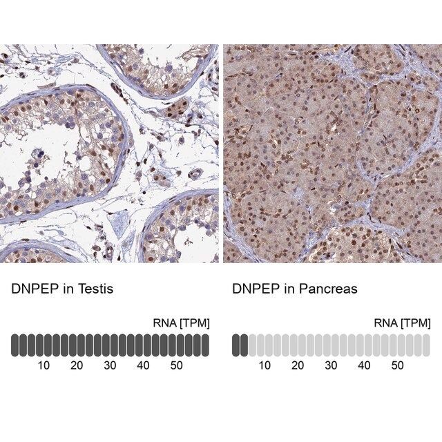 Anti-DNPEP antibody produced in rabbit