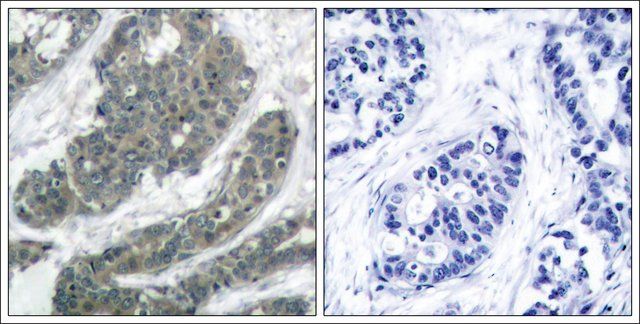 Anti-DOK1 (Ab-398) antibody produced in rabbit