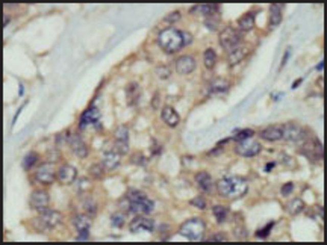 Anti-DOK5 (C-term) antibody produced in rabbit