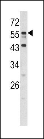 ANTI-DONSON (N-TERM) antibody produced in rabbit