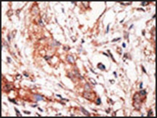 Anti-DOK4 (C-term) antibody produced in rabbit