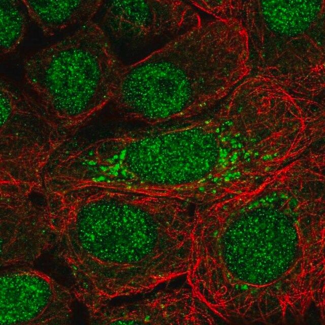 Anti-DOPEY2 antibody produced in rabbit