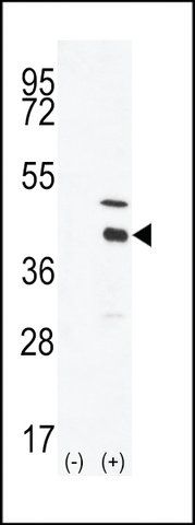 ANTI-DOK4(C-TERMINAL) antibody produced in rabbit