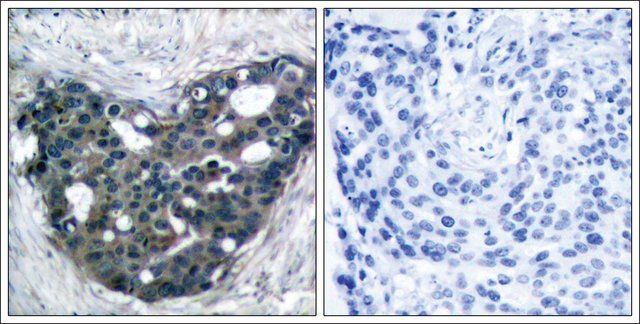 Anti-DOK2 (Ab-299) antibody produced in rabbit