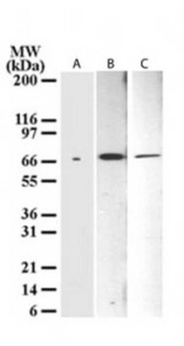 Anti-Np73 Mouse mAb (38C674)