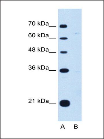 Anti-DONSON antibody produced in rabbit