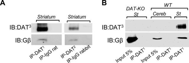 Anti-Dopamine Transporter Antibody, NT, clone DAT-Nt