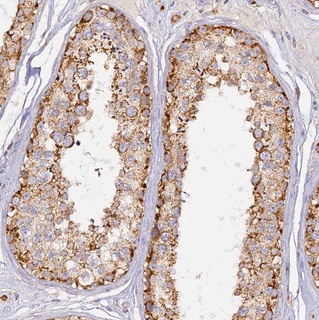 Anti-DONSON antibody produced in rabbit