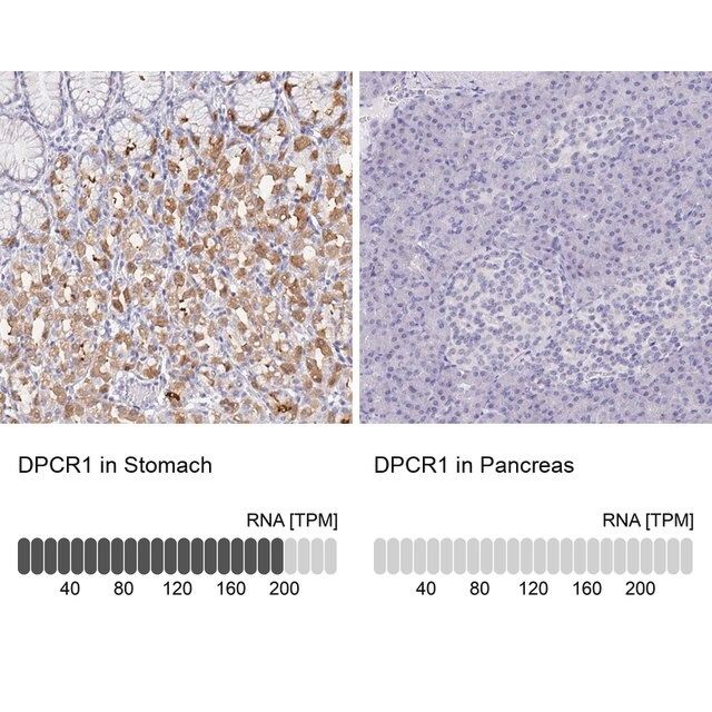 Anti-DPCR1 antibody produced in rabbit