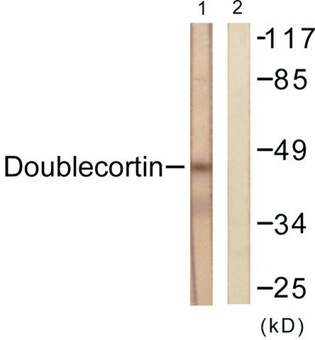 Anti-Doublecortin antibody produced in rabbit