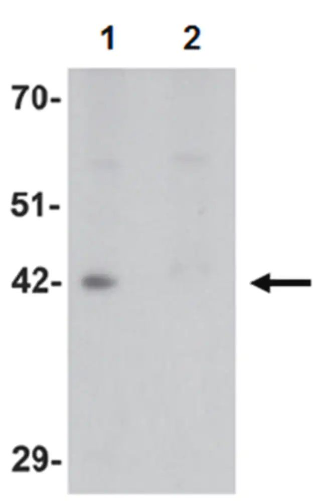 Anti-DPAGT1 Antibody