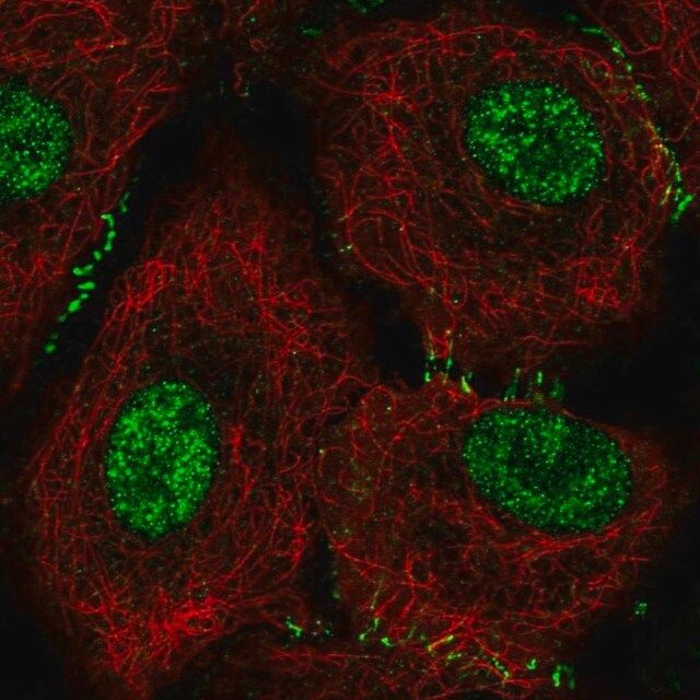 Anti-DPH1 antibody produced in rabbit