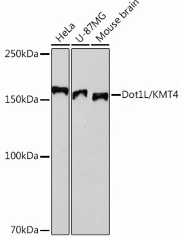 Anti-Dot1L/KMT4 antibody produced in rabbit