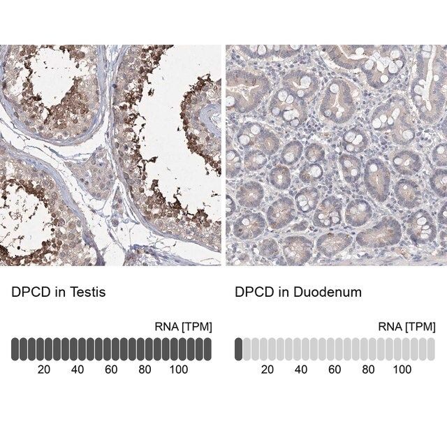 Anti-DPCD antibody produced in rabbit