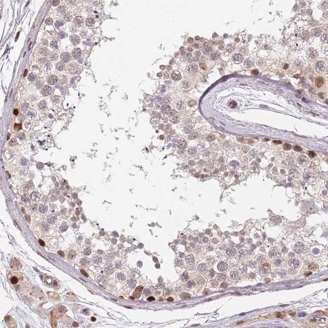 Anti-DPH2 antibody produced in rabbit