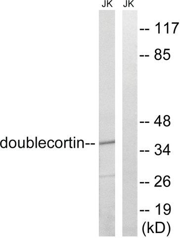 Anti-Doublecortin antibody produced in rabbit