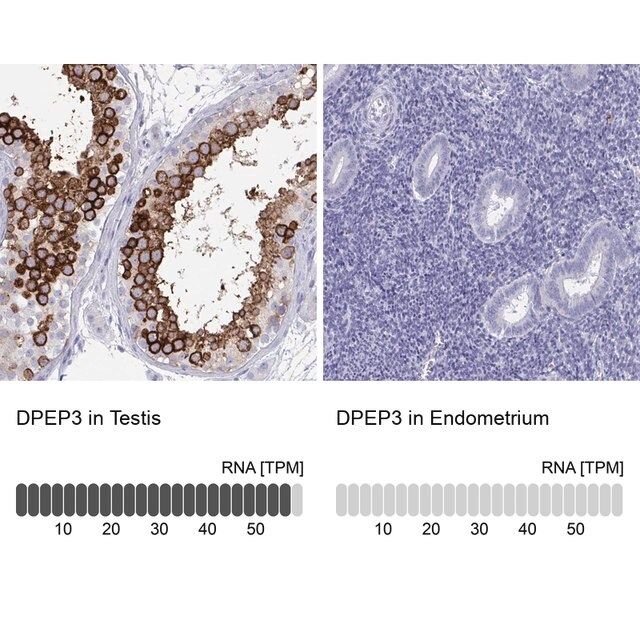 Anti-DPEP3 antibody produced in rabbit