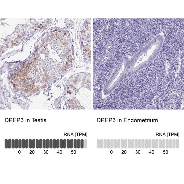 Anti-DPEP3 antibody produced in rabbit